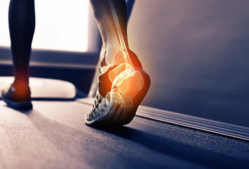 sports-injuries-s13-achilles-tendonitis